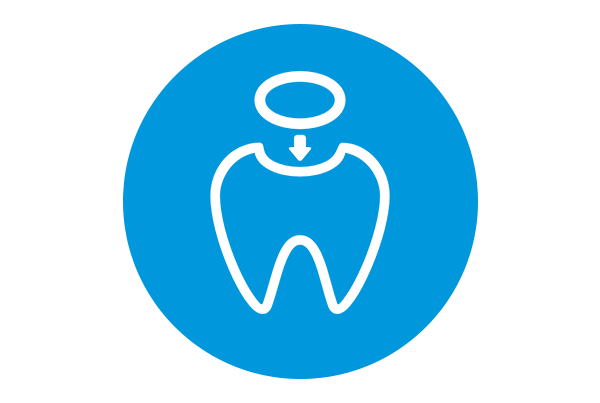 Dental Filling