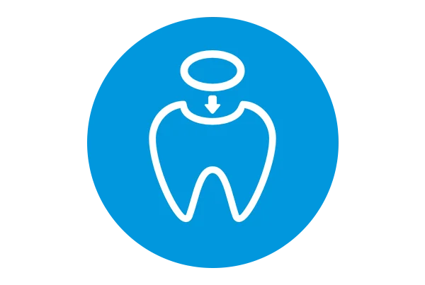 Dental Filling