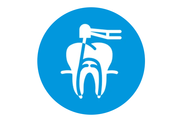 Root Canal Treatment