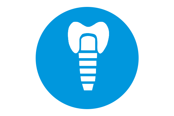 Dental Implant