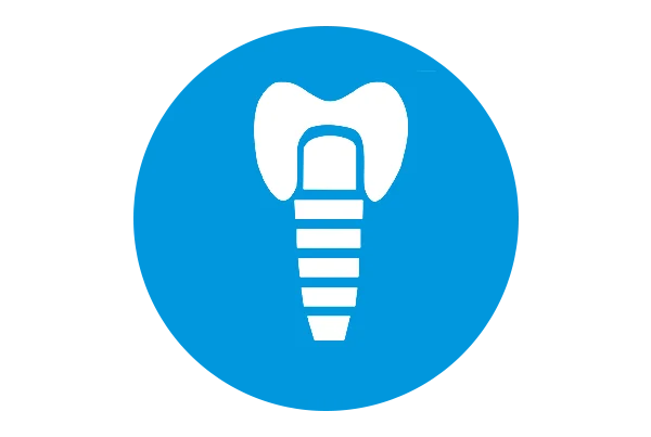Dental Implant